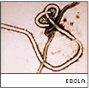 EbolaVMicro.gif