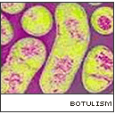 BotulismVMicro.gif