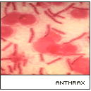 AnthraxVMicro.gif