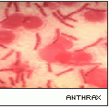 AnthraxVMicro.gif